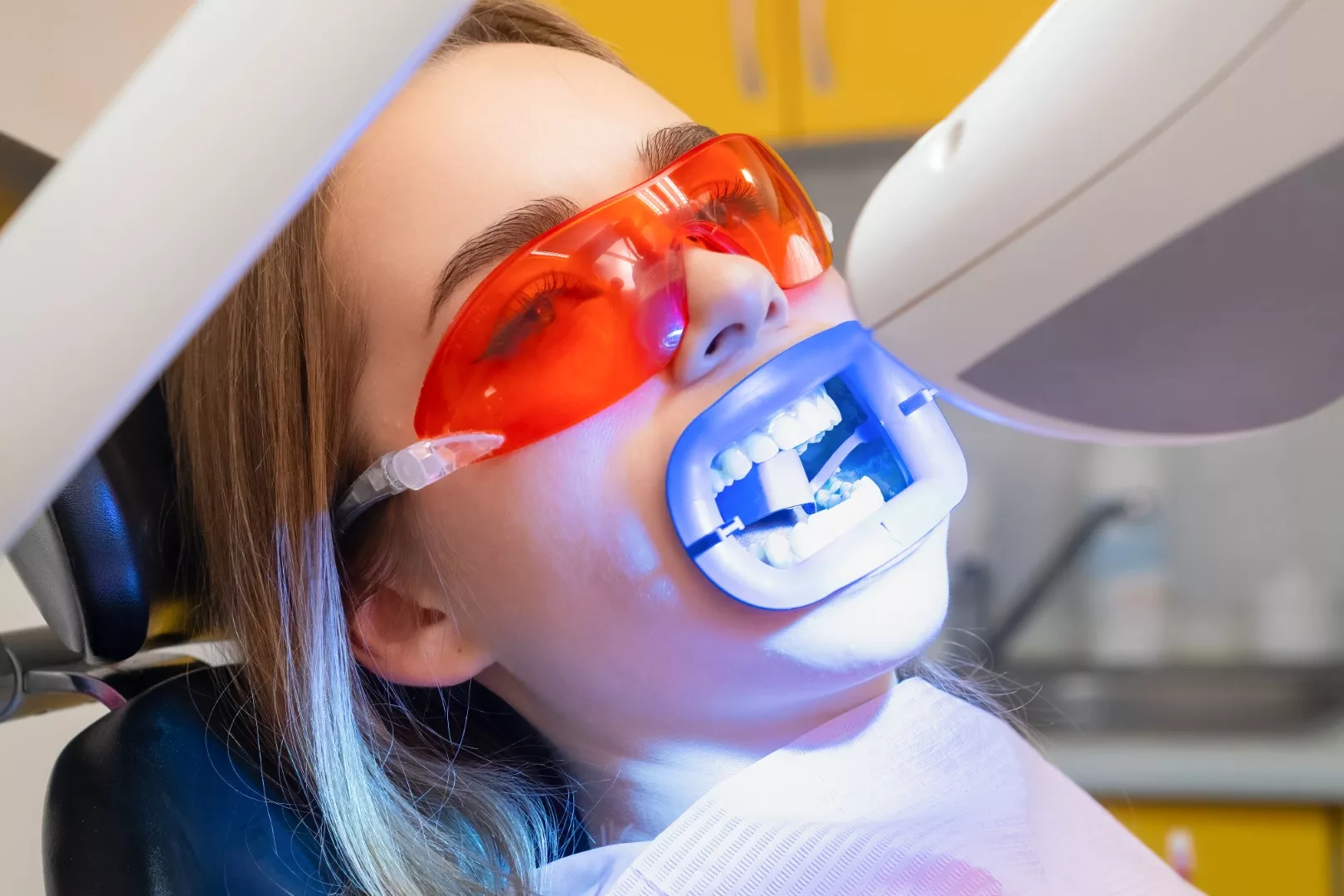 Teeth Whitening in Bronx and NYC By Dr. Sameh Aknouk
