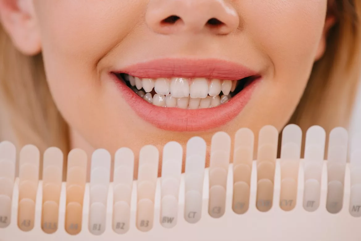 Achieving a Brighter Smile: The Power of Teeth Whitening in Bronx and New York City