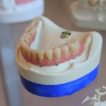 A Comprehensive Guide to Crown Longevity: How Long Do Crowns Last?