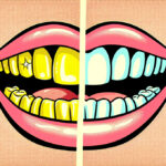 The Ultimate Guide to Teeth Whitening Methods